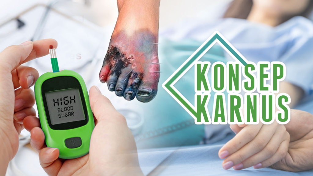 Konsep Karnus dalam Penyembuhan Diabetes